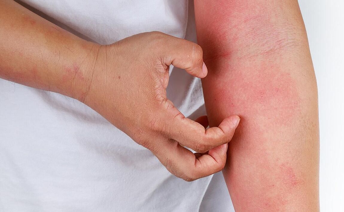 deacrachtaí féideartha ó úsáid a bhaint as sóid